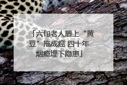 六旬老人唇上“黄豆”拖成癌 四十年烟瘾埋下隐患